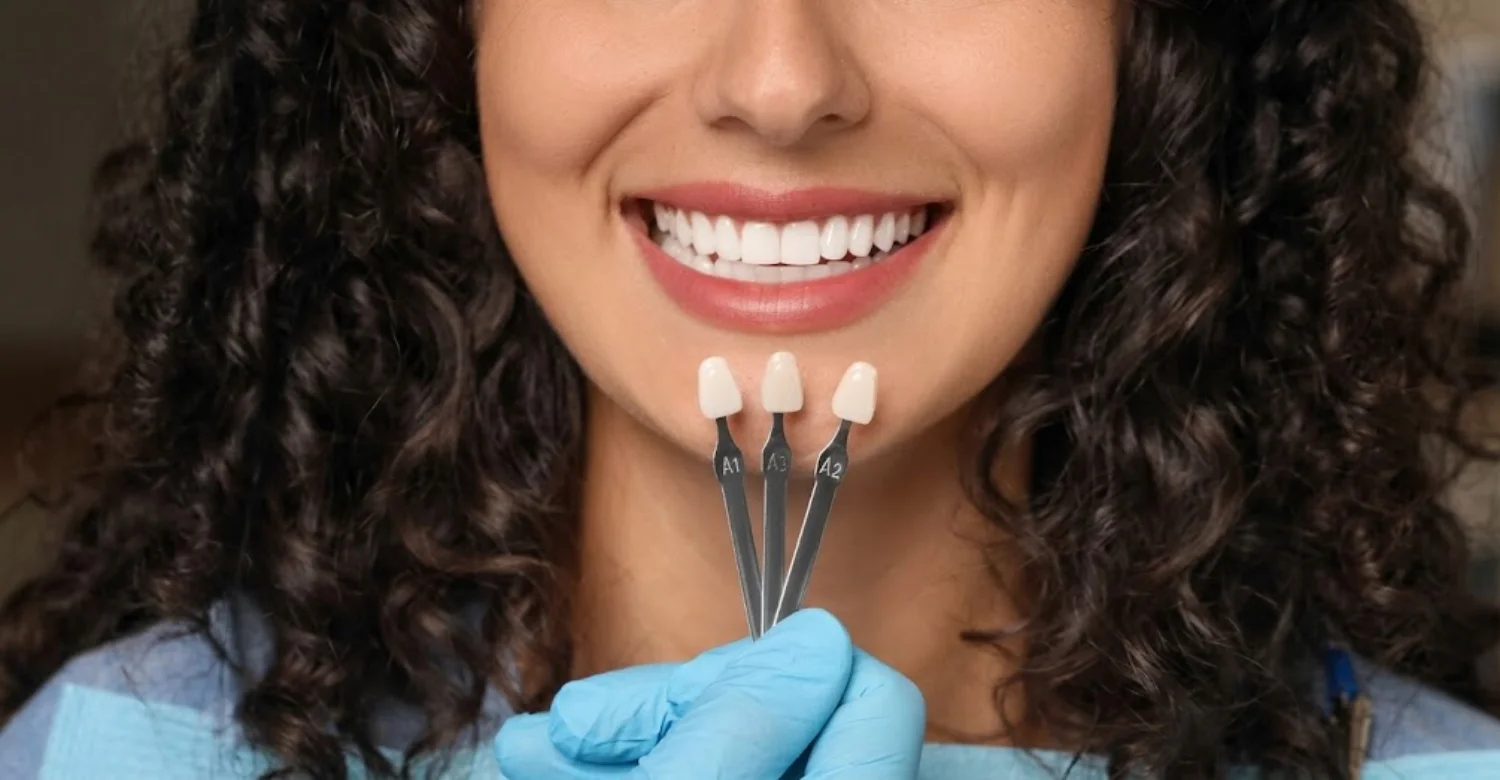Dental Veneers Benefits 2